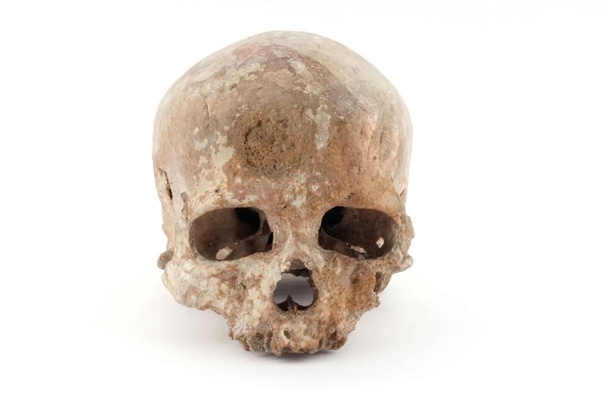 Un crâne humain usé par le temps, avec des dents manquantes, sur un fond blanc uni.