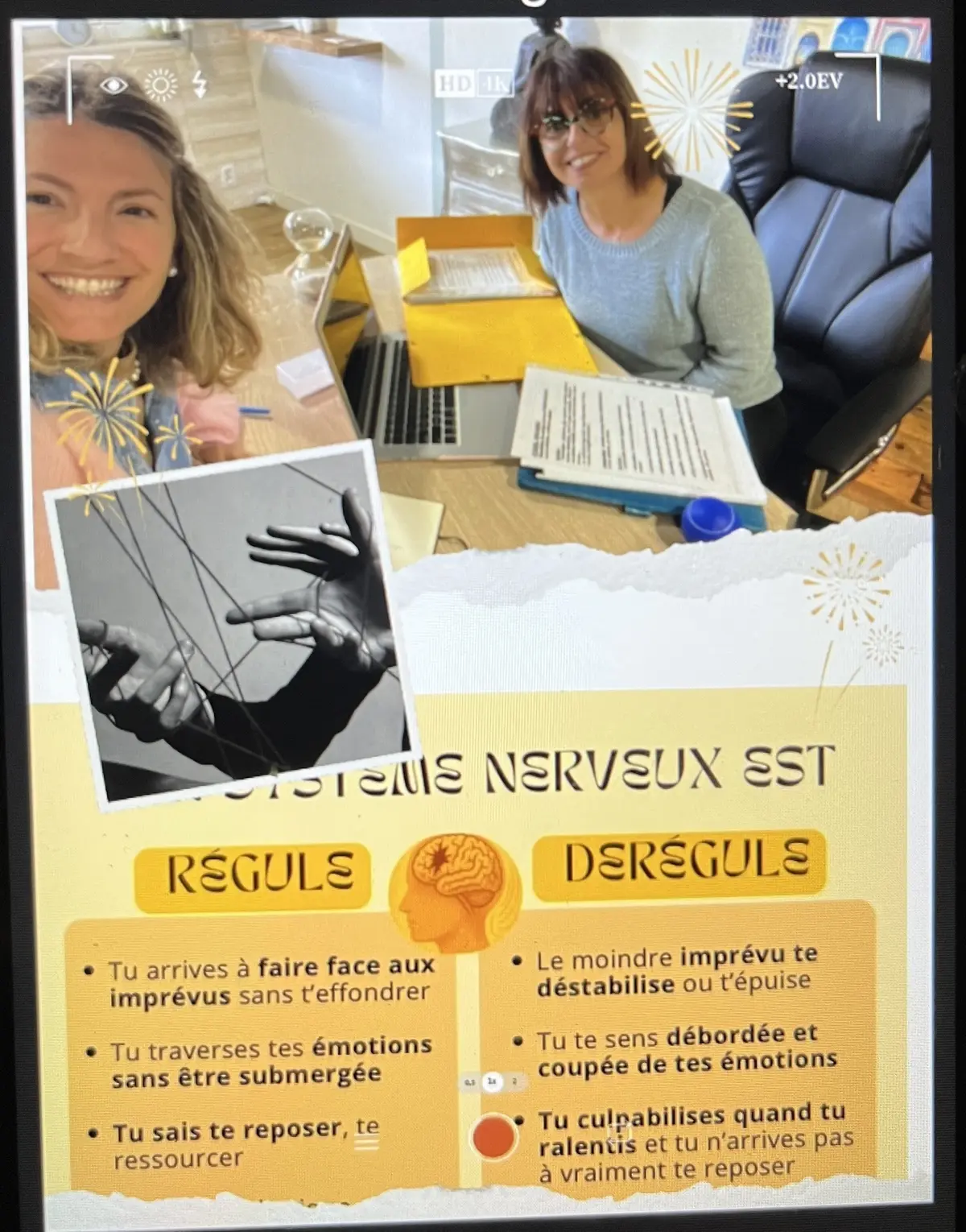 Atelier système nerveux