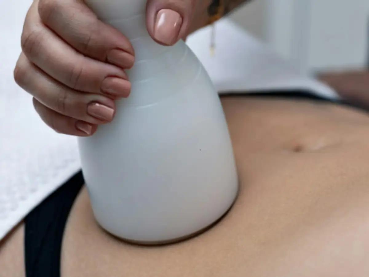 Cryolipolyse à Saint-Clémence-de-Rivière (34)