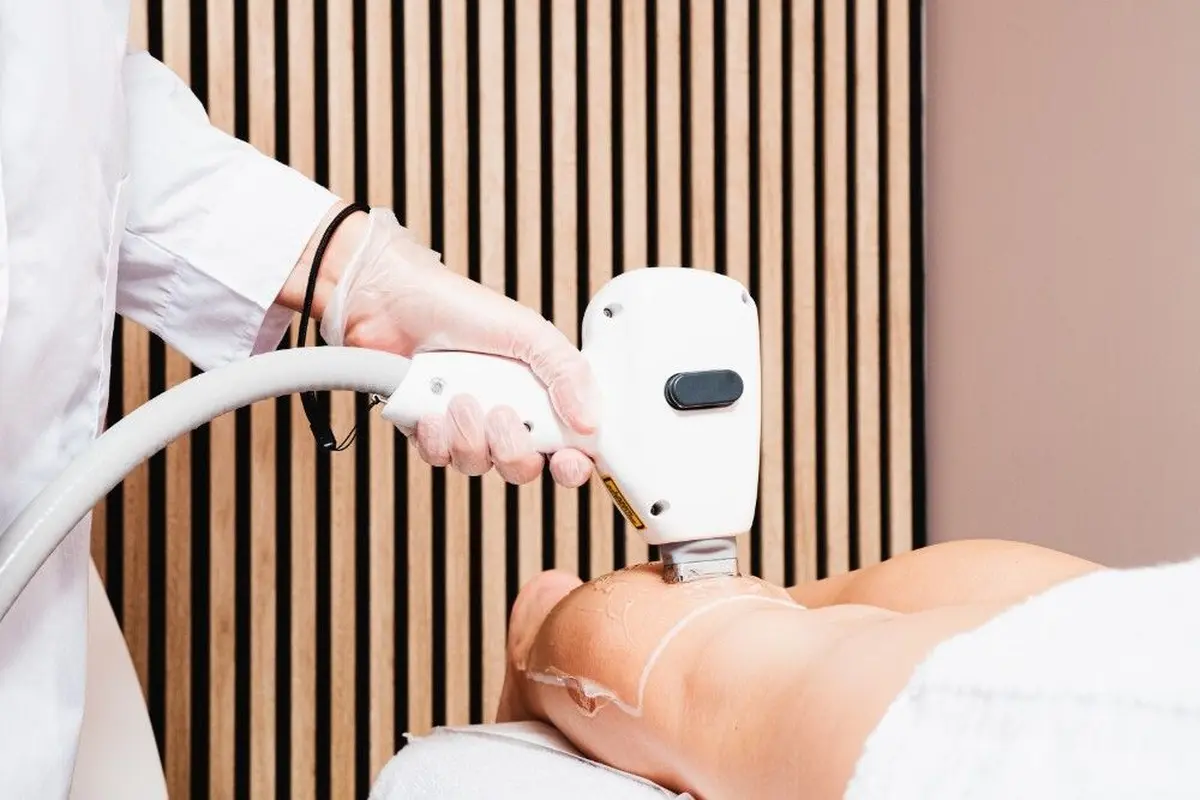 Épilation laser à Strasbourg : smartduck ouvre son premier centre dans le Grand Est