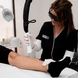 Épilation laser et détatouage à Reims-Bezannes : faire appel à un expert esthétique