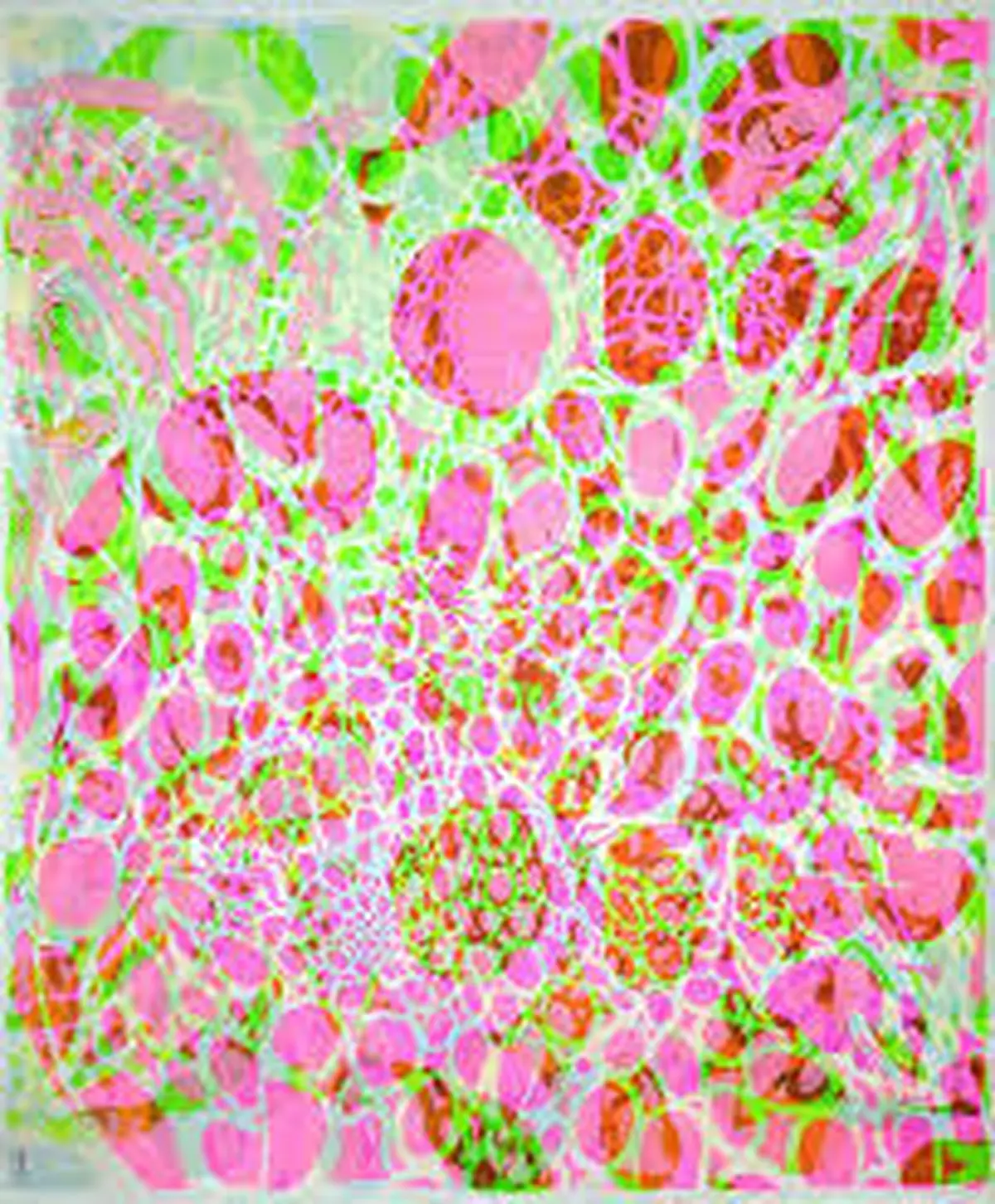 Exposition ACHAO - Galerie l'App'Art