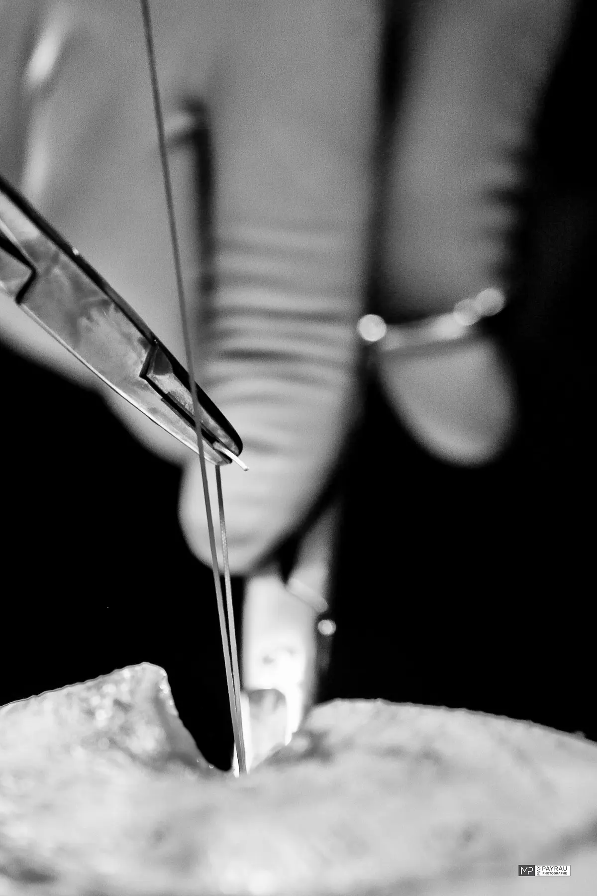 Exposition Photographies Chirurgie 