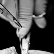 Exposition Photographies Chirurgie 