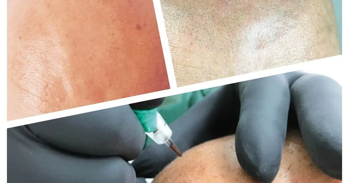Gérald’IN Dermo Studio Mulhouse - Beauté et soin