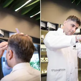 Pourquoi Istanbul attire autant de patients pour une greffe de cheveux