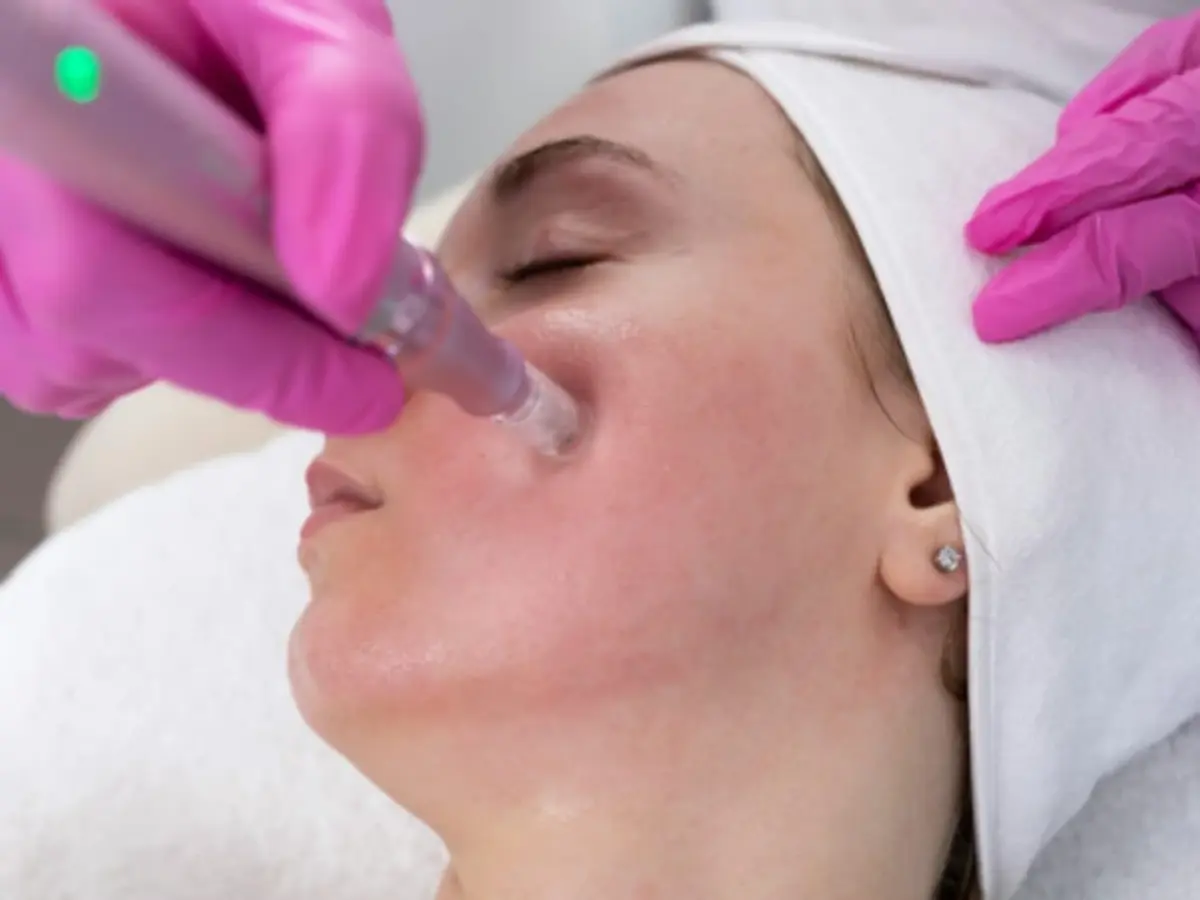 Soin du visage anti-âge avec le Proton-Pen à Toulouse (31)